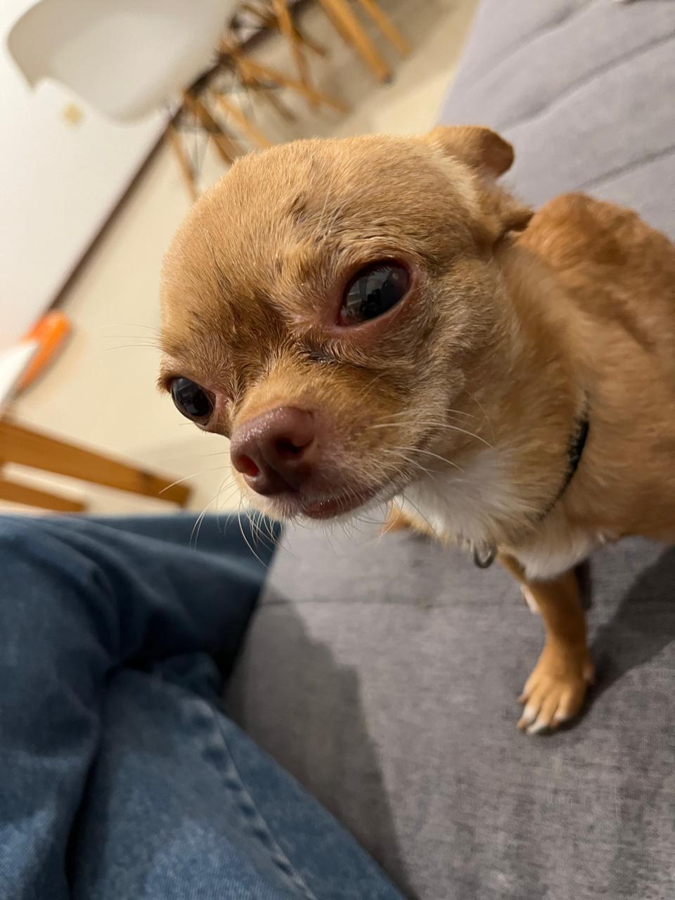 Lorenzo Pablito con el párpado caído y el ojo lastimado, ilustrando lagrimeo e irritación